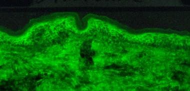Direct immunofluorescence microscopy performed on 