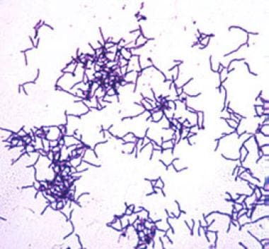 Actinomyces israelii (non–spore-forming, gram-posi
