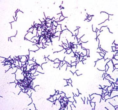 Actinomycosis in Ophthalmology Background Pathophysiology