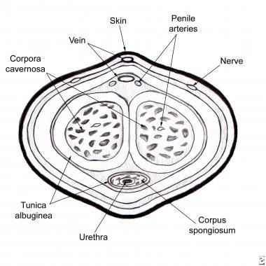 Urethral strictures. Cross-sectional diagram of th