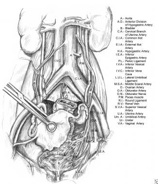 Relevant anatomy of the ureter, illustrating its c