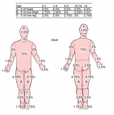 Pediatric Burn Percentage Chart