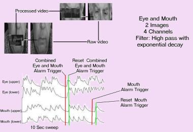 Filter technique applied to eye and mouth images (