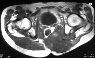 Axial T1-weighted magnetic resonance image (same p