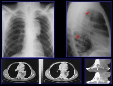 Differential diagnosis. Posteroanterior (top left)
