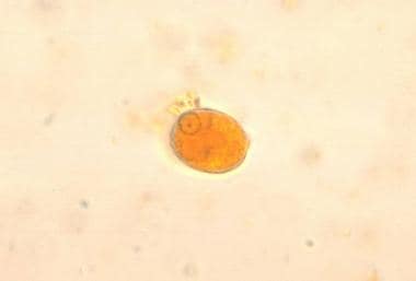 Entamoeba histolytica cyst. Image courtesy of Cent