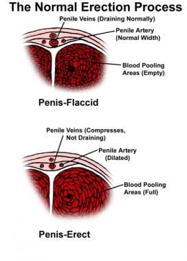 These images depict penile anatomy. Note the sinus
