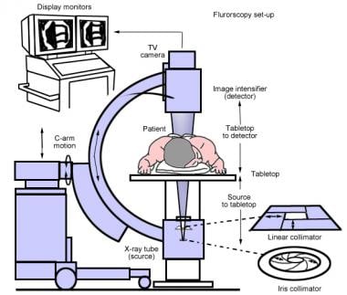 parts 60 of machine cobalt Therapeutic for Types Management: Injections Pain of