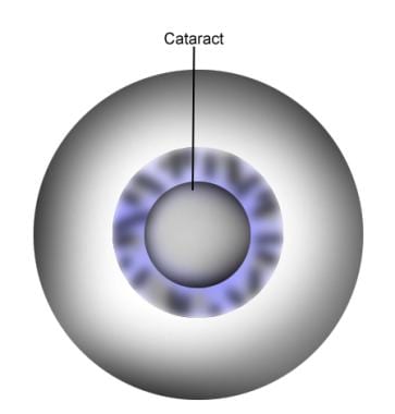 Eye Lense Contact - Best Price in Singapore - Jan 2024