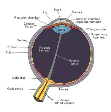 bacterial keratitis symptoms