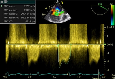 Heart Failure Workup Approach Considerations Routine Laboratory