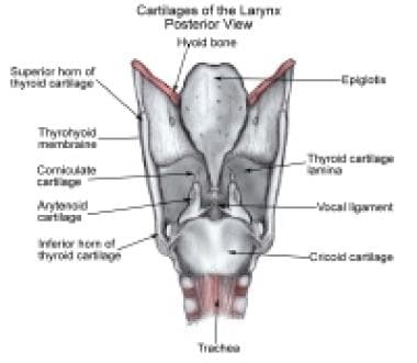 arytenoid cartilage intubation