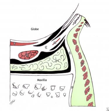 Anatomy of the lower lid. The orbicularis oculi (O