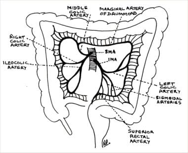 drainage system of kidney Ileocecal Background, Indications Resection: