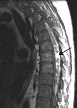 Sagittal noncontrast T1-weighted magnetic resonanc