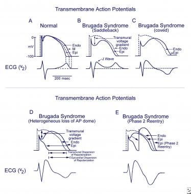 Schematics show the 3 types of action potentials i