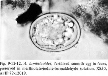 
Ascaris lumbricoides egg. 