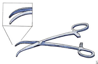 Guidewire dilator forceps (GWDF). 