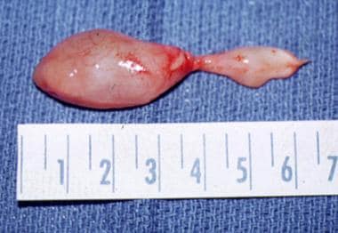 Scale is in inches. The left side of the lesion wa