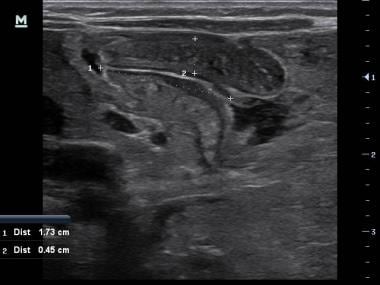 Point-of-care ultrasound performed by a pediatric 