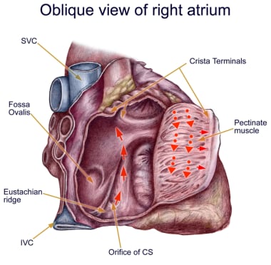 Anatomy of classic counterclockwise atrial flutter