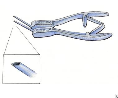 Rapitrach dilating forceps. 