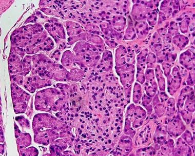 Normal pancreas. There are fewer paler-staining ne