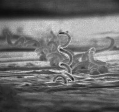 Electron micrograph of Treponema pallidum.
