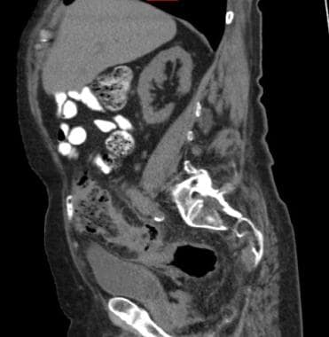 Acute presentation of an 87-year-old man with righ