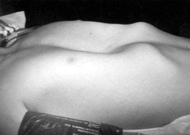 Preoperative photograph of a 12-year-old boy prior