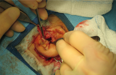 Intraoperative image of a right ear meatoplasty.