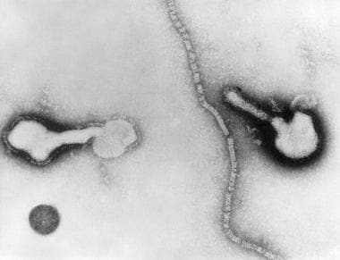 Transmission electron micrograph of parainfluenza 