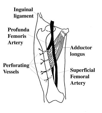 Lateral Thigh and Anterolateral Thigh Free Tissue Transfer: Background ...