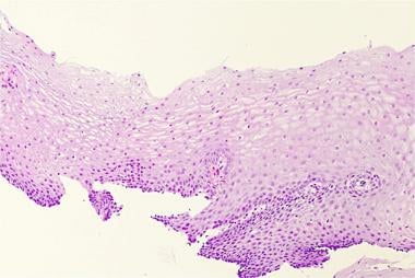 Normal histology of the esophagus. 