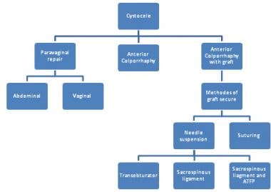 Cystocele Treatment - Gynecologic & Reconstructive Surgery