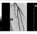Imaging in Lower-Extremity Peripheral Artery Disease (PAD)