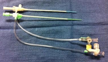 Radial artery sheath insertion. Shown are 5-Fr and