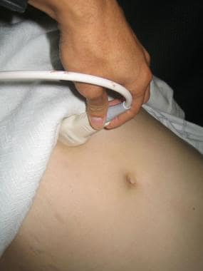 Scanning upper abdomen in longitudinal plane to vi
