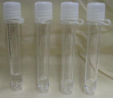 Four vials of cerebrospinal fluid.