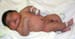 Estimation of Fetal Weight