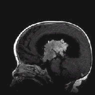 Sagittal T1-weighted contrast-enhanced magnetic re