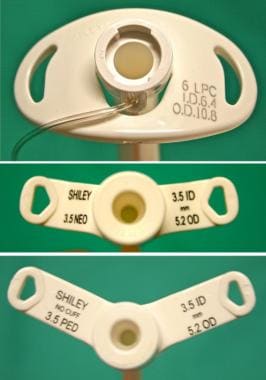 Pediatric Tracheostomy: Overview, Periprocedural Care, Technique