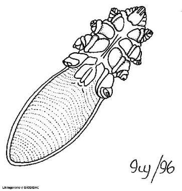 Illustration of Demodex folliculorum. Reprinted wi