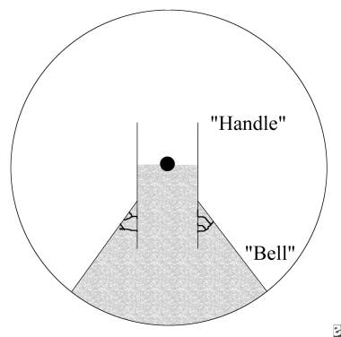 Diagram illustrating the layout of the bell flap. 