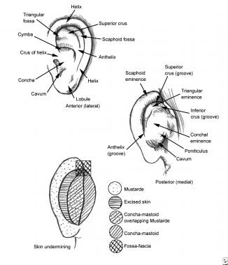 korvaruston anatomia, anterior (lateral)