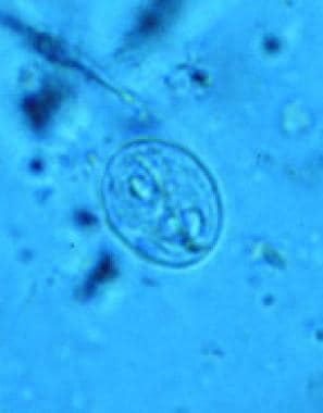 Giardiasis. Giardia lamblia, cyst form. 