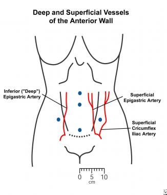 Port Position of Various Laparoscopic General Surgeries