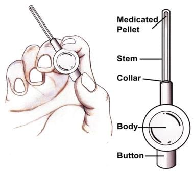 what is a suppository applicator