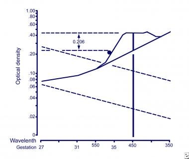 Liley curve. This graph illustrates an example of 