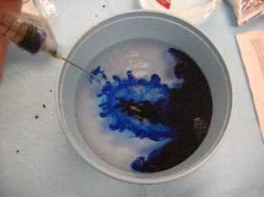 Adding methylene blue to normal saline solution. 
